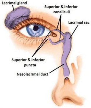 Lacrimal duct Surgery